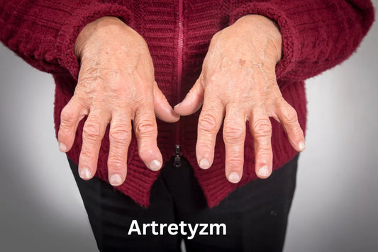 Artretyzm: Co to jest, objawy i jak sobie z nim radzić